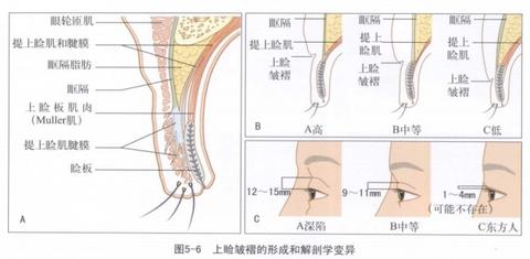 双眼皮成都