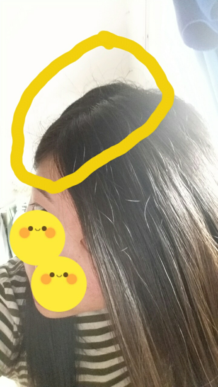 新<em>长</em>出来<em>的头发</em>翘在<em>头顶怎么</em>办,看起来好燥,用