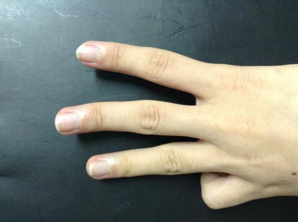 习惯性把手指关节掰响对关节影响大么?如何戒掉?