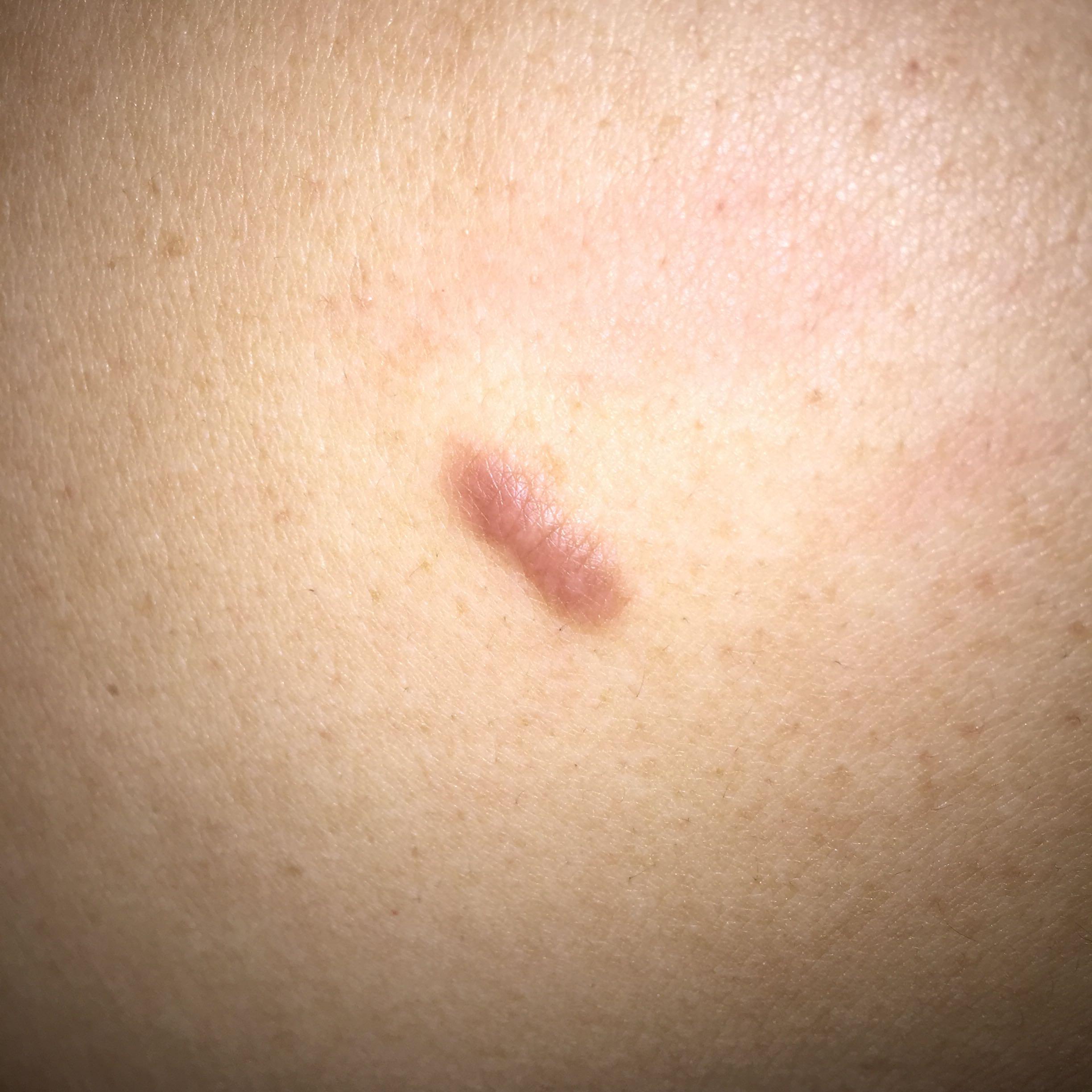 请问这个是不是皮肤病?严重吗?