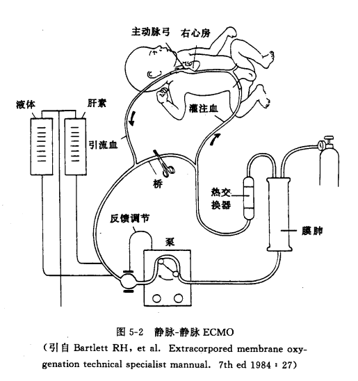 1953年体外循环应用于心脏手术而登上历史舞台,当时就有人想把这个