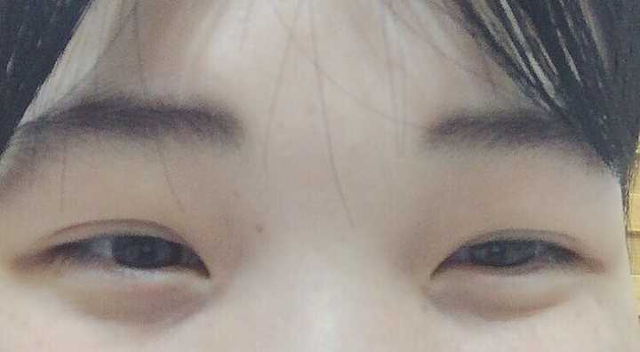 不是因为眼睛小眯成一条缝的?