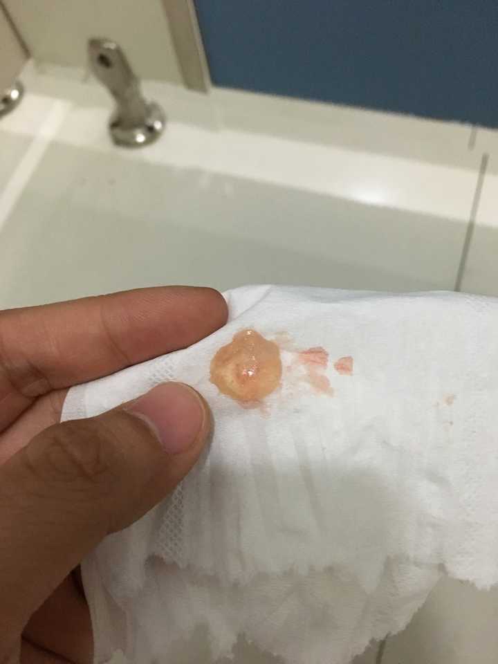 家乡机场的厕所里,我亲眼目睹了胎囊掉出来,就是这个半透明的小圆球.