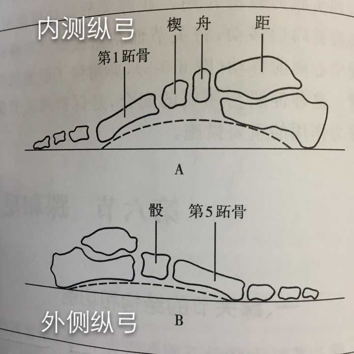 足弓有纵弓和横弓.