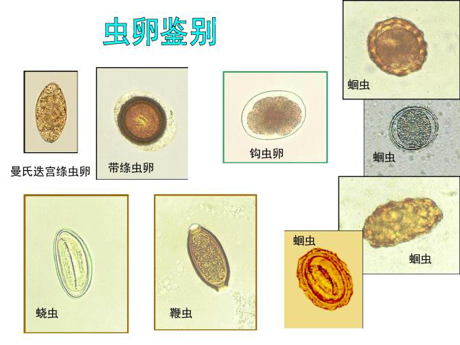 一般来说虫卵较小,需在光学显微镜下才可以看到. 有的成虫肉眼可见.