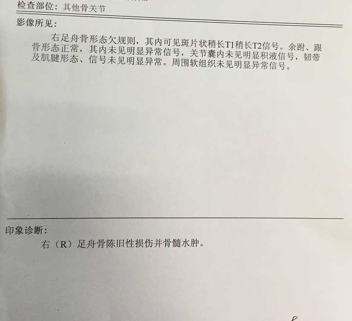 脚扭伤两个半月仍然疼mr显示足舟骨陈旧性损伤并骨髓水肿需如何治疗