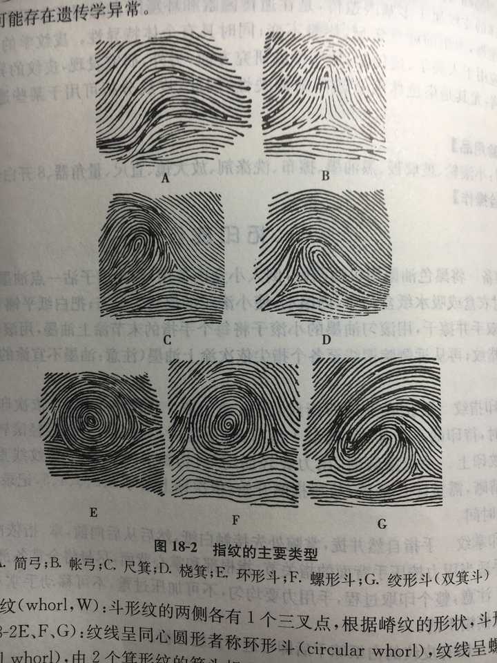 箕形(纹路从一侧出发,走向对侧指端,有一个三叉点).