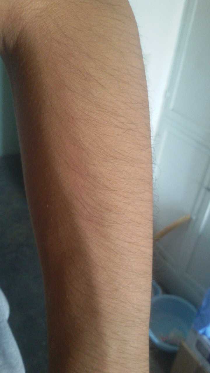 体毛旺盛的受会被嫌弃吗?