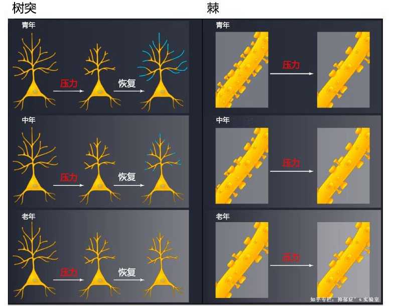 改变,比如神经细胞的树突发生萎缩,组成兴奋性突触的树突棘发生丢失
