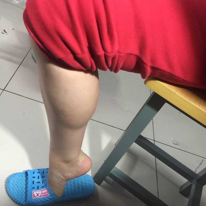 小腿肌肉发达的女生如何塑型?