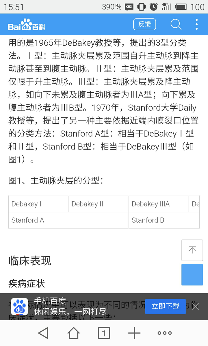 主动脉夹层的debakey分型和stanford分型的来历是什么