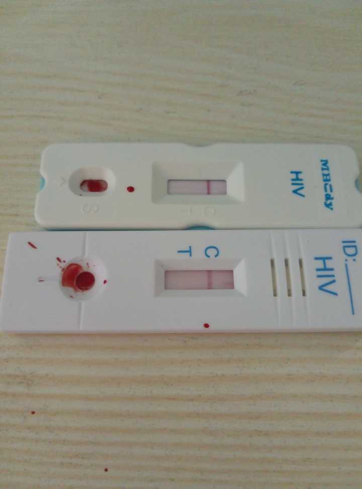 普通人到底如何检测是否艾滋病hiv