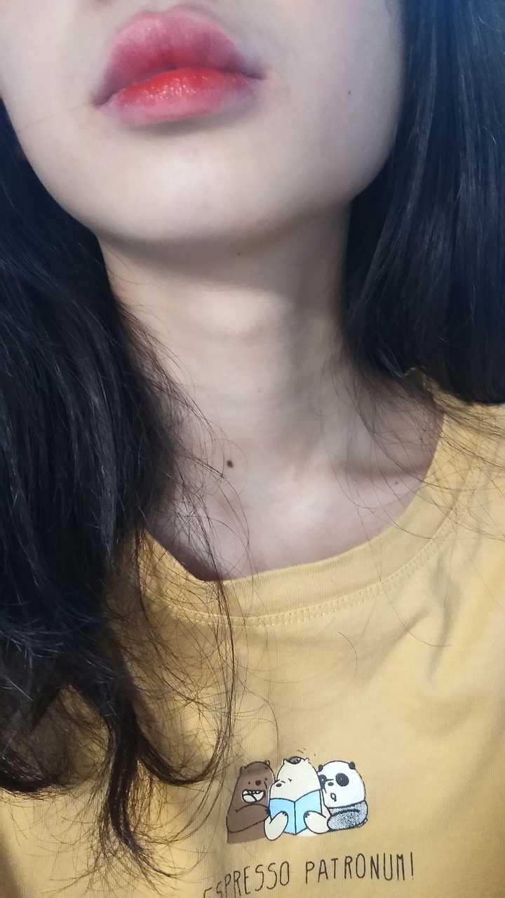 女生长喉结怎么办?是因为太瘦了还是激素分泌不正常?
