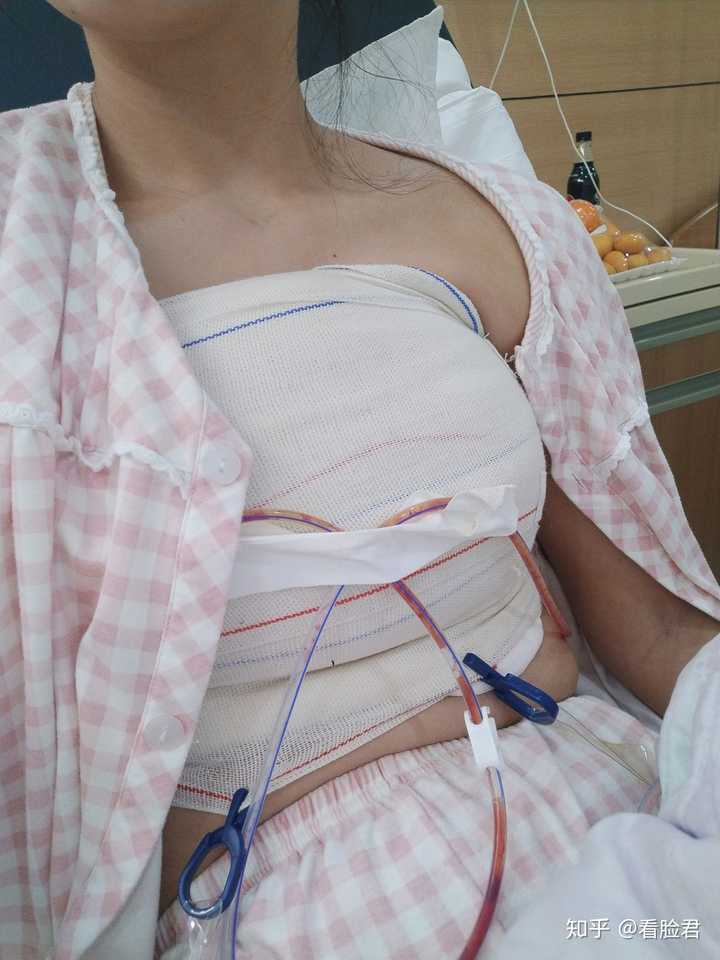 隆胸后是什么样的体验,感觉?