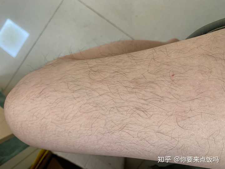 女生腿毛旺盛是怎样的人生体验