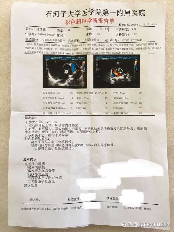 小儿被诊断动脉导管未闭和房间隔缺损怎么办