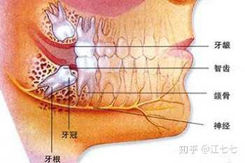 长智齿就肯定会牙疼么?