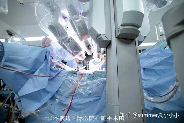心脏搭桥手术真的有效安全吗?
