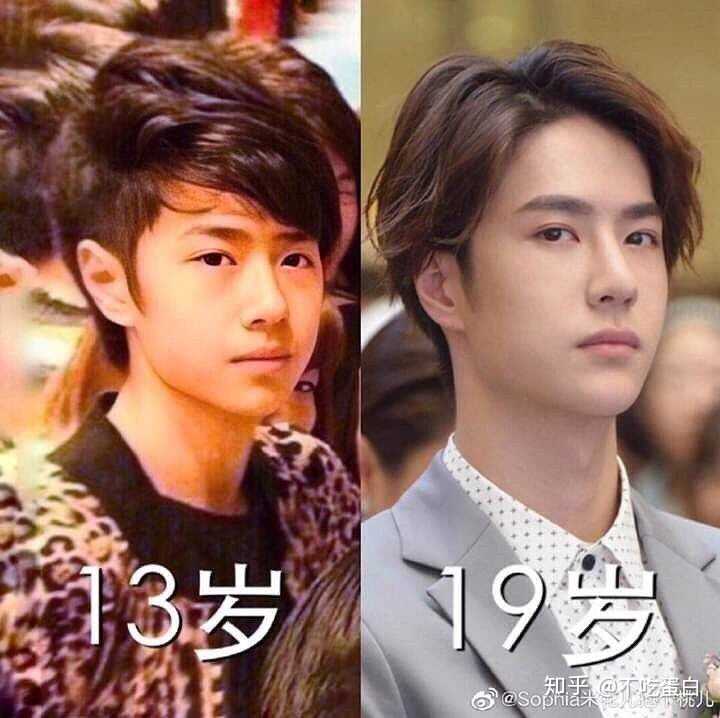 王一博整容了吗?