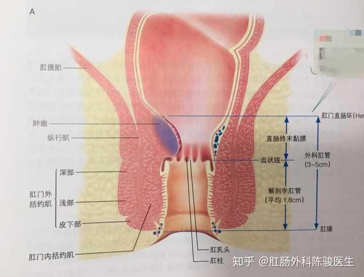 肛管的内面由肛柱,肛瓣,肛窦,肛乳头等组成.