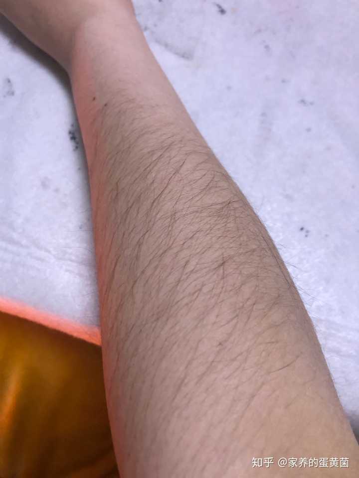 女生体毛旺盛是什么样的体验?