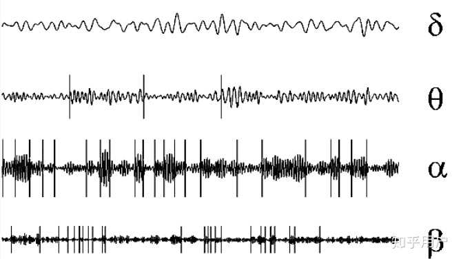 整体的脑电波状态可能可以对应很多种不同的情况,比如你出现阿尔法波