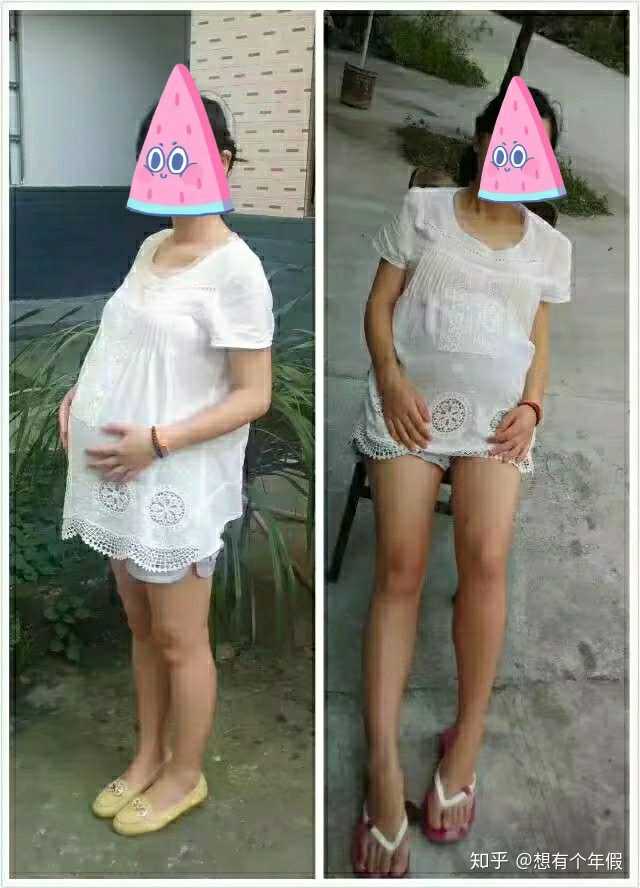 做过剖腹产的宝妈怀二胎是一种怎样的体验?
