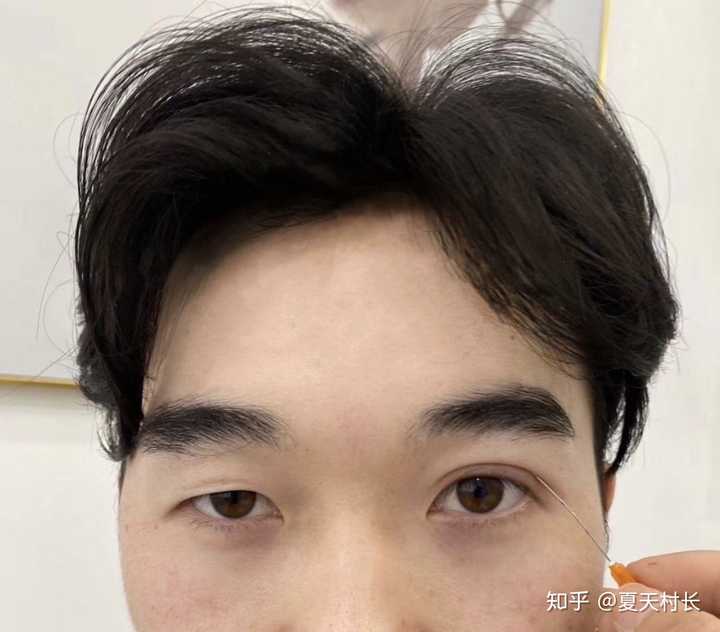 男生割双眼皮怎么看?