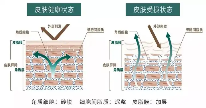 秋季皮肤干燥脱皮怎么办?