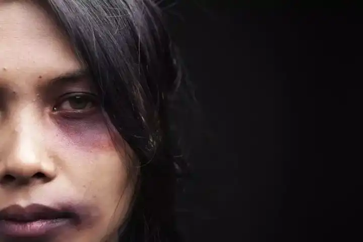 美妆博主宇芽自曝遭遇家暴,面对家庭暴力,女生应该如何保护自己?