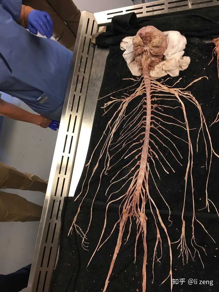 人的神经部分解剖(human neuron system dissected)