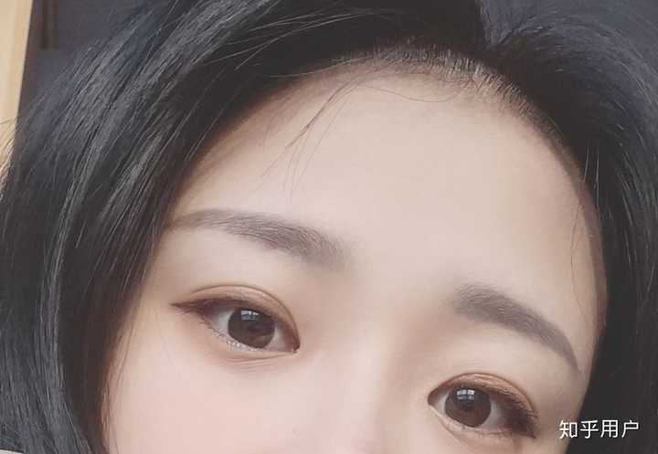 割双眼皮/开眼角对一个人的外貌能有多大提升?
