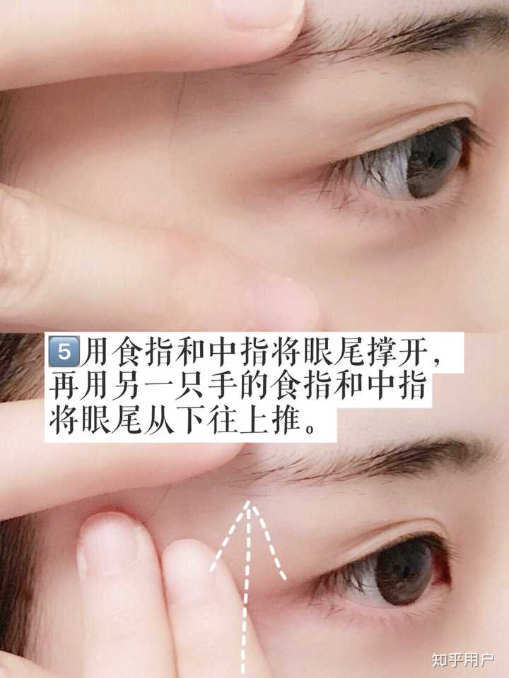 怎么从单眼皮自然变成双眼皮?