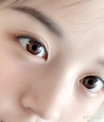 为什么有些中国人的眼睛是棕黄色的