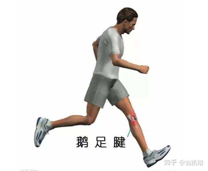 十天前运动过量,右膝盖内侧左下方疼痛,说是鹅足炎,怎样恢复更快?