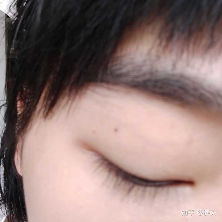 为什么有人说妖痣可怕妖痣究竟长在哪里