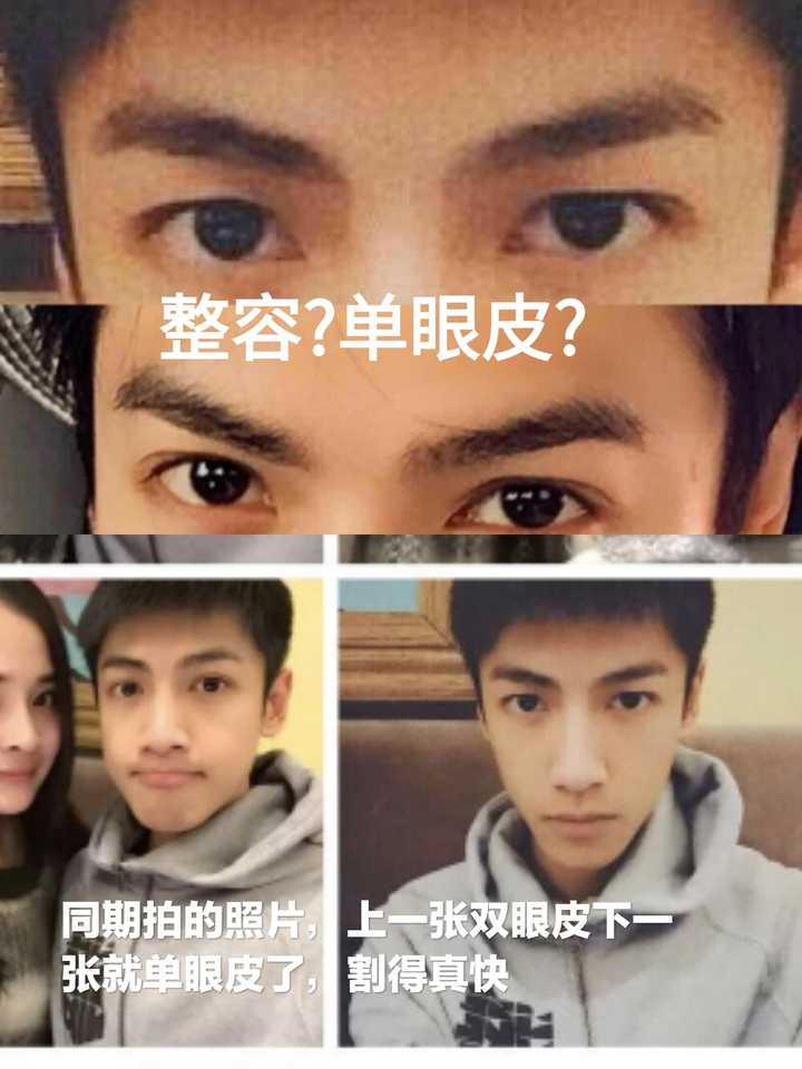 罗云熙是不是整容了?