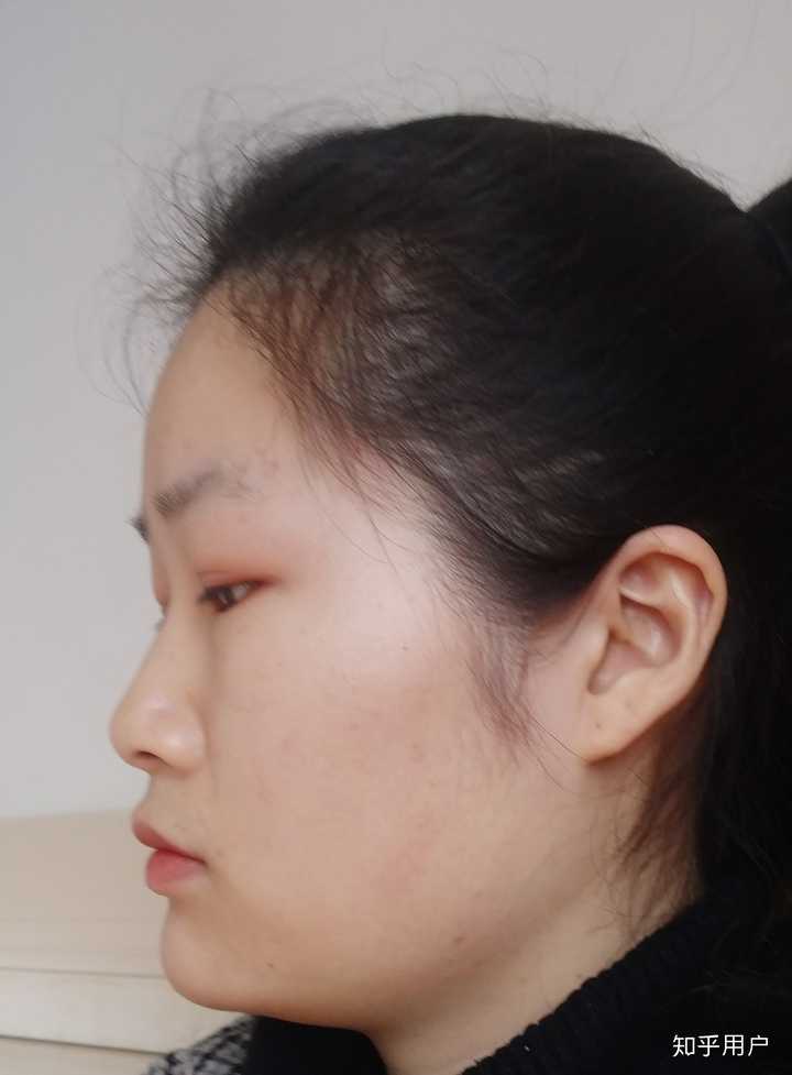 女生侧脸不好看怎么办?