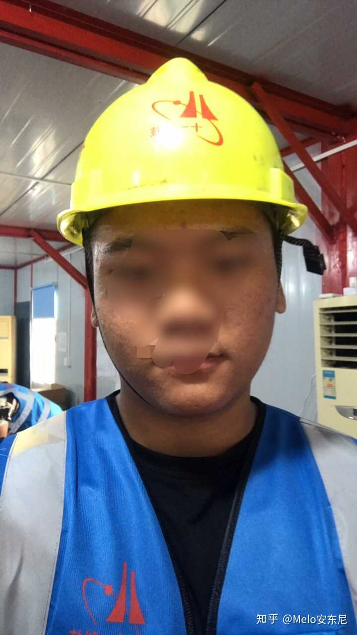男生胸部的脂肪很多胸部凸出来穿衣服胸前两个大包一直被人嘲笑该怎么