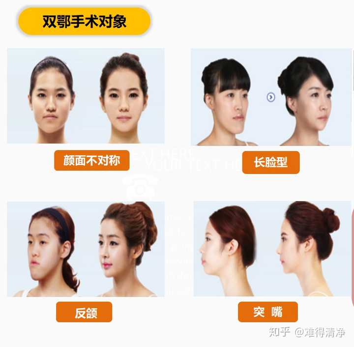 正颌手术的风险是什么?