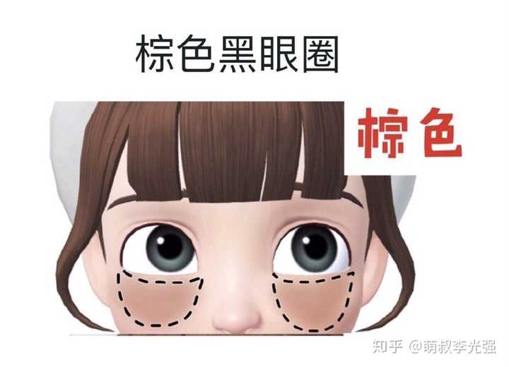 泪沟,眼袋,黑眼圈同时存在该如何缓解?