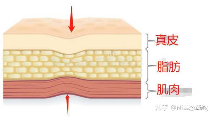 小孩子为什么冰棍吃多了容易吃出酒窝也蛮好理解的,口角外侧的脂肪对