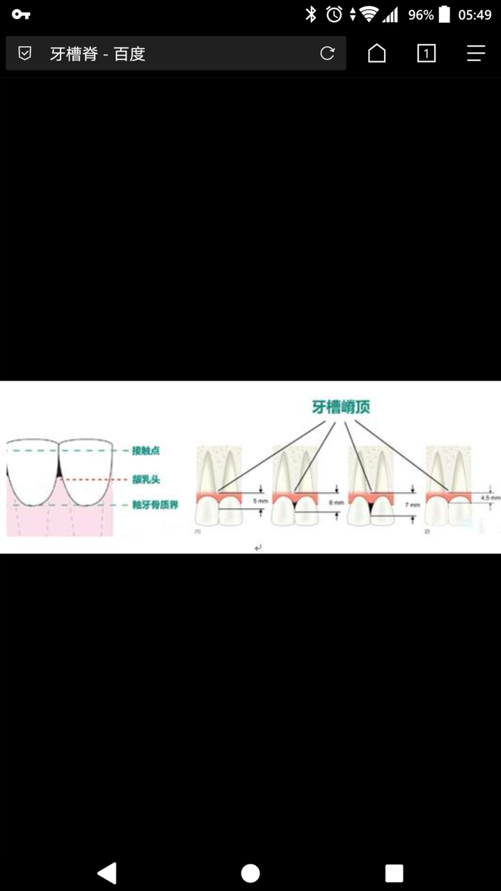 牙槽嵴是什么是牙龈吗还是牙根牙尖