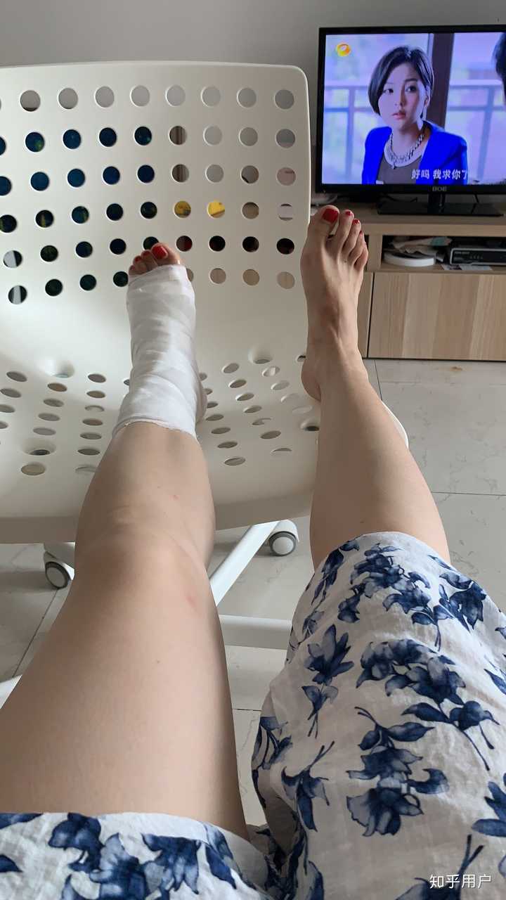 这次包扎后,特别像打了石膏.