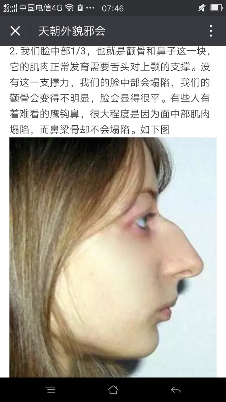 我这个鼻子是有什么问题?是不是就是山根塌陷?有没有别的问题?