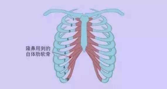 适用于鼻畸形,反复整形失败或对鼻整形要求极高的人群.