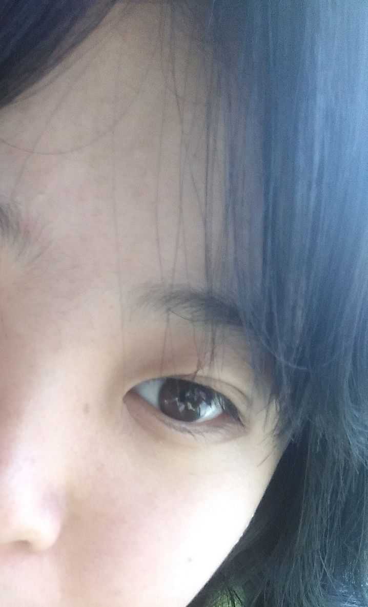 下眼睑上有一条不明显的线为什么有的人没有?