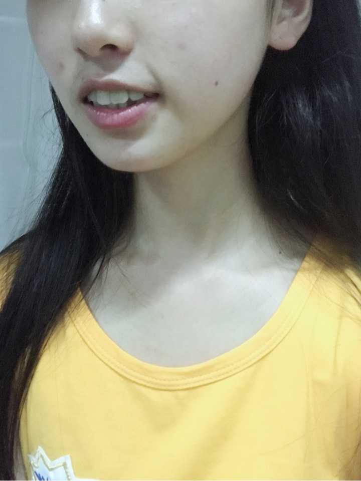 牙齿还是有点不整齐.外鲍.