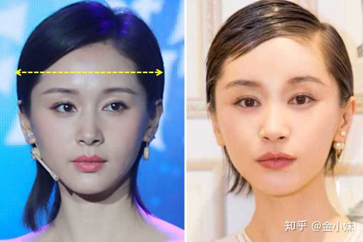 笑容甜美治愈的人五官脸型有哪些结构特点?