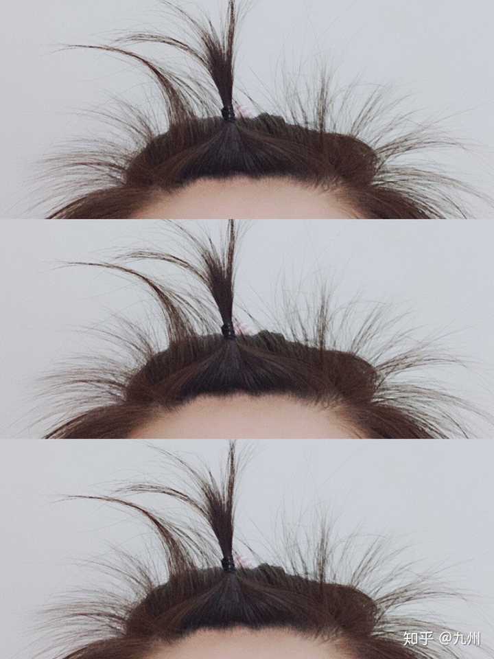 女生秃顶是怎样一种体验?